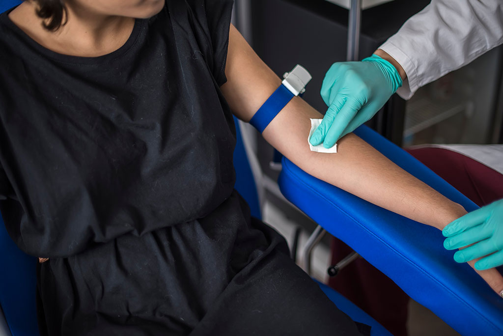 Prelievo di sangue nel Punto Prelievi SYNLAB di Rovato