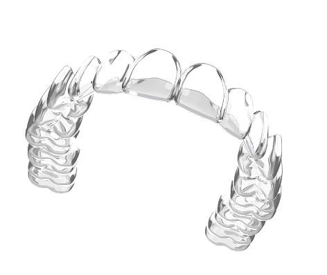 Allineatori dentali invisibli