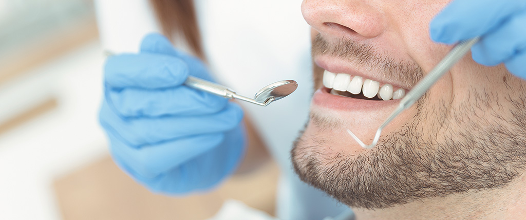 Trattamento di estetica dentale: sbiancamento dentale