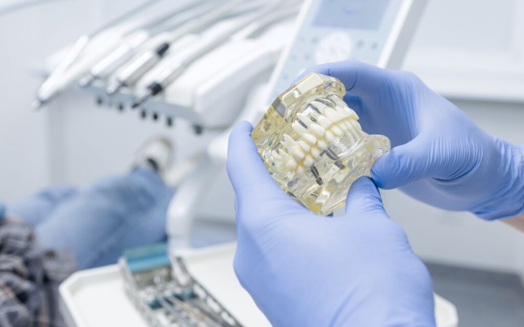 Overdenture o protesi fissa? Differenze, vantaggi e quale scegliere