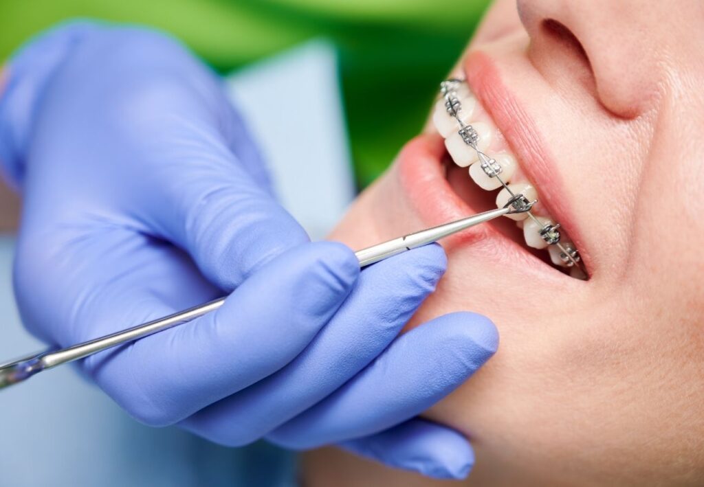 Cosa correggiamo con il servizio di ortodonzia presso i Centri Dentali Zanardi