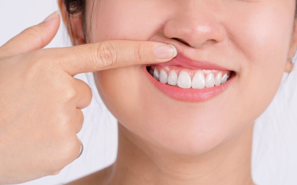 What Is Periodontitis and How Is It Treated?