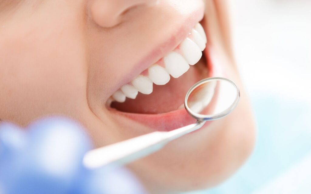 Getting your teeth redone at Centri Dentali Zanardi improves your smile and self-esteem