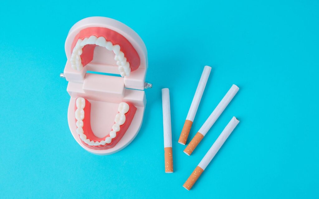 Dental Implants and Smoking: What You Need to Know